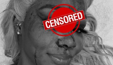 Jade Cargill Shows Off Nasty Gash Following SmackDown