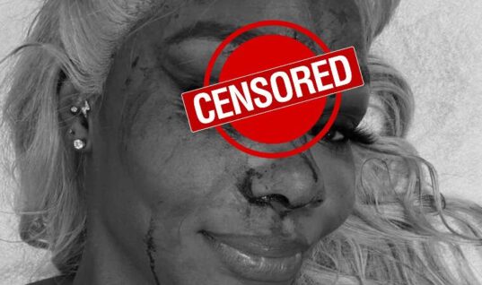 Jade Cargill Shows Off Nasty Gash Following SmackDown