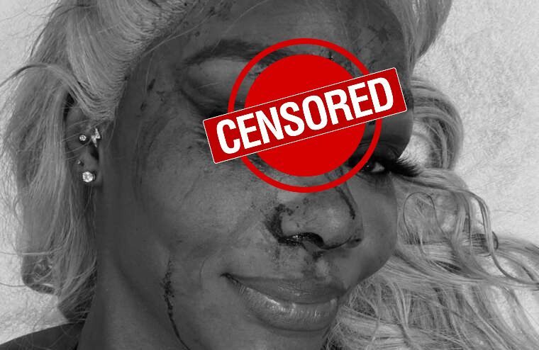 Jade Cargill Shows Off Nasty Gash Following SmackDown