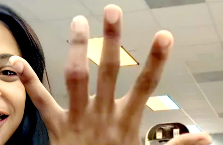 WWE Star Confirms She’s Getting Surgery Nearly One Year After Suffering Injury